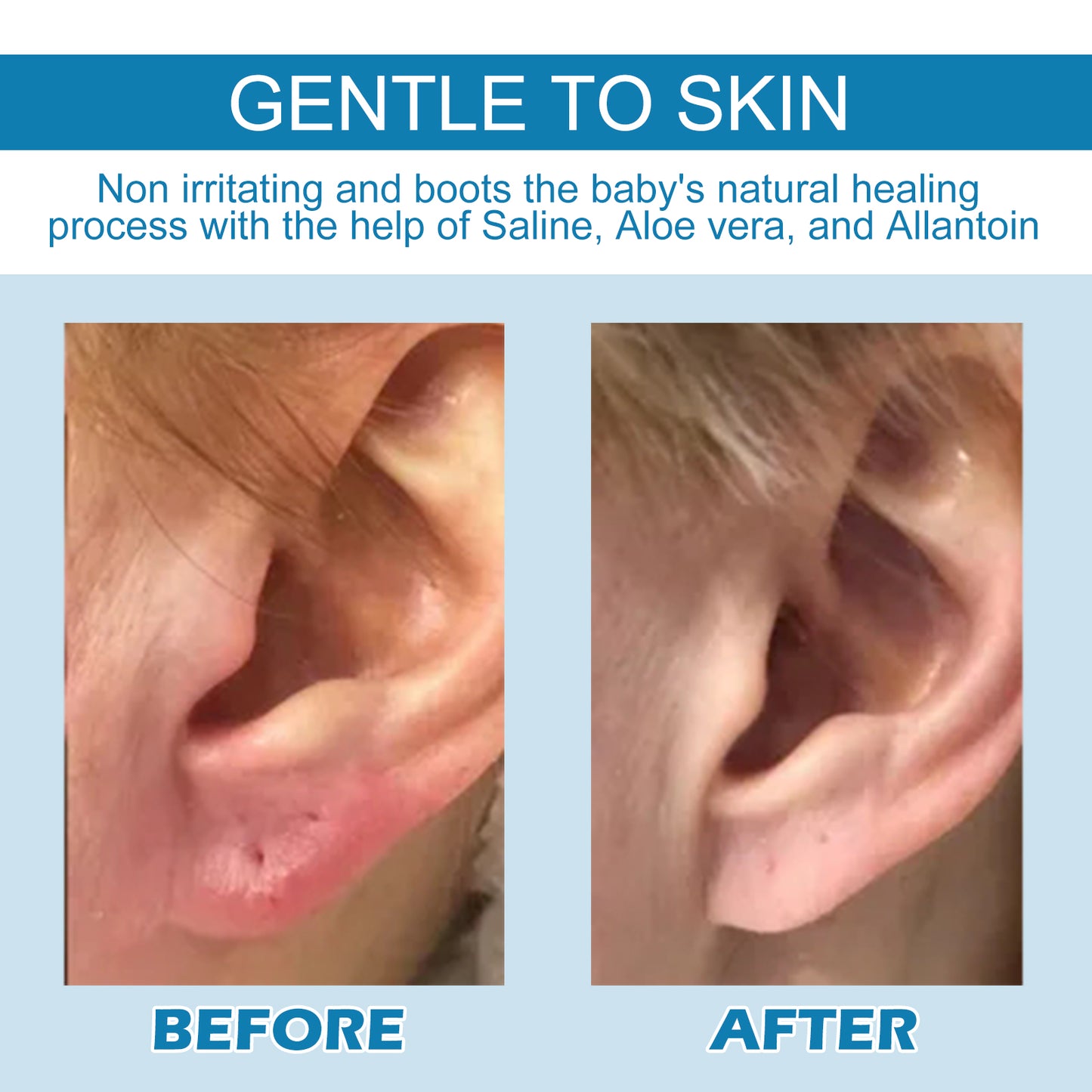 EELHOE Piercing Repair Drops For Ear Piercing Care Gently Relieves Piercing Lumps And Moisturizes Skin